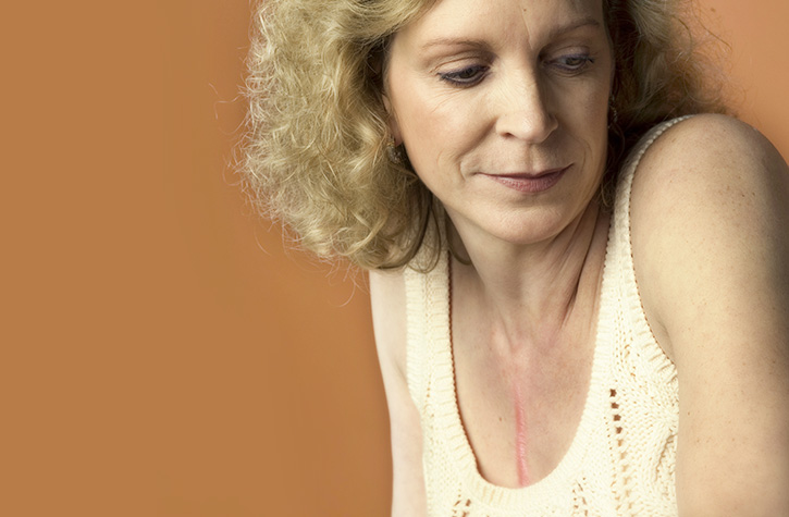 转化基因组学:HLA