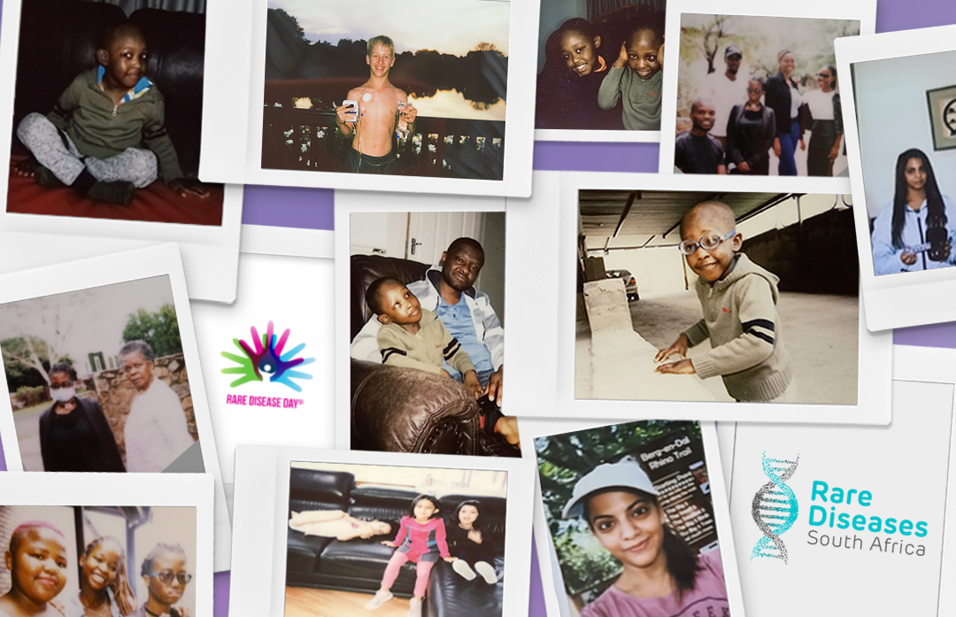 “罕见病无所不在”：在南非拥抱罕见病