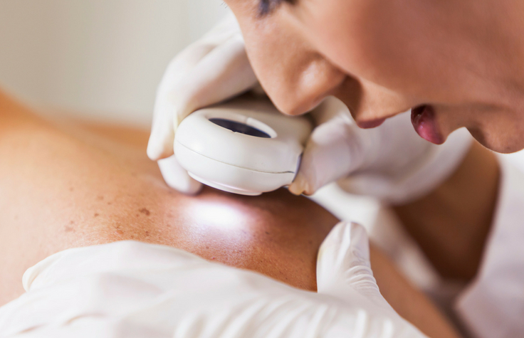 Genomics Podcast: Eczema and the Human Skin Microbiome