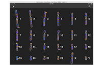 MyGenome - Chromosome Overview