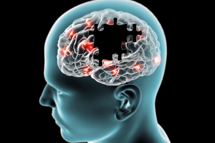 Gleaning Genetic Insight about Neurodegenerative Disorders